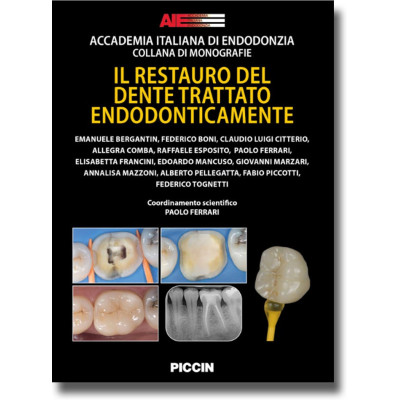 AIE. Il Restauro del Dente...