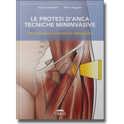 Candiotto. Le Protesi...