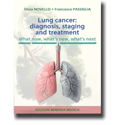 Novello. Lung cancer:...