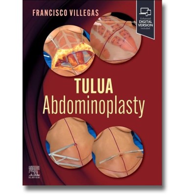 Villegas. TULUA Abdominoplasty